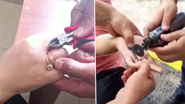 Parmaklarına sıkışan yüzükleri itfaiye çıkardı
