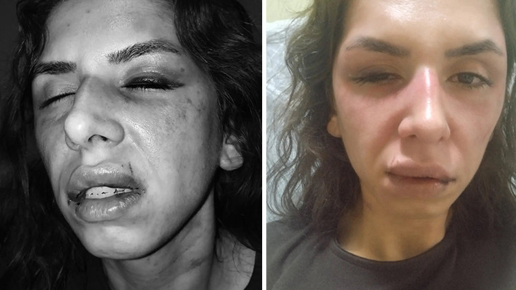 Eşini darbeden koca tutuklandı