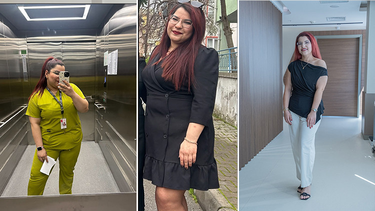 Ankara'da tüp mide ameliyatı olan hemşire Burcu, 9 ayda 42 kilo verdi