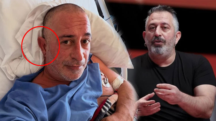 Kulak memesindeki çizgi kalp krizi sebebi mi? Ünlü komedyende de varmış...