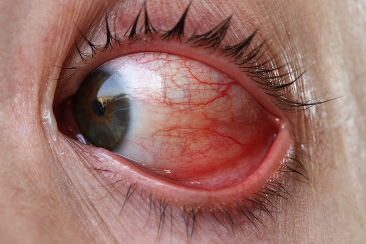 Tıp tarihinde bir ilk Retinal nakil yapıldı, yıllar sonra yeniden görmeye başladı