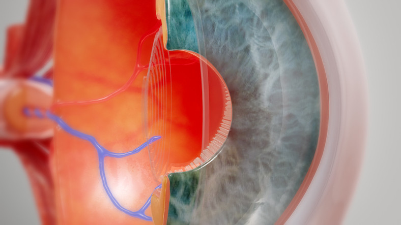 Tıp tarihinde bir ilk Retinal nakil yapıldı, yıllar sonra yeniden görmeye başladı