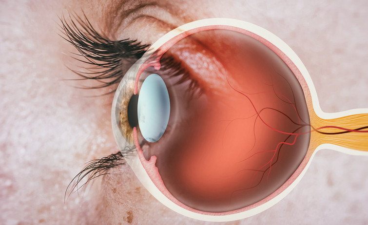 Tıp tarihinde bir ilk! Retinal nakil yapıldı, yıllar sonra yeniden görmeye başladı
