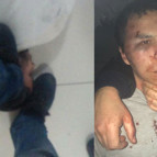 Operasyon sonrasında bunlar yaşandı