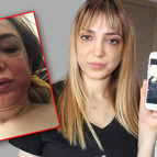 Estetik mağduru kadının yüzü tanınmaz hale geldi