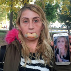 Güzellik uğruna hayatı karardı