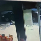 Beyin cerrahının parmakları akılalmaz kazada koptu