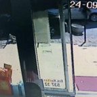 Beyin cerrahının parmakları akılalmaz kazada koptu