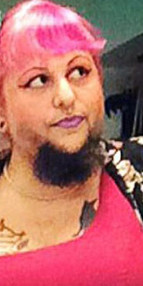 Hastalığı yüzünden sakalları var