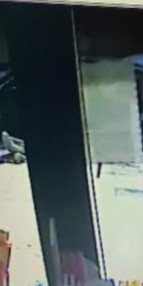 Beyin cerrahının parmakları akılalmaz kazada koptu