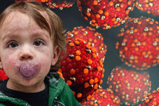 Sessizce yayılıyor! Dünyanın çeşitli yerlerinde vakalar ve ölümler artıyor... İşte Türkiye’deki durum