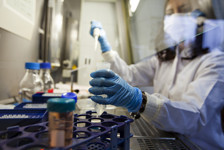 İdrar renginin dilini anlamak: Her renk ne anlama geliyor?