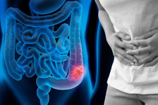 Bilim insanları yeni bir tedavi keşfetti! Gençler arasında yayılmaya başlamıştı... O kanser tarih mi oluyor?