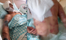 Köpeklerin saldırısında ağır yaralanan kadın: Komşum olmasa öldürmüşlerdi