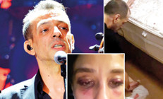 Şiddet bu kez Rubatonun solistinden: Yerdeki kanları temizledi