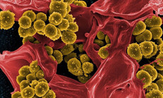 Antibiyotiklere dirençli bakteriler ‘koronavirüsten daha riskli