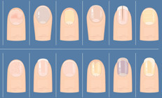 Bana tırnağını göster sana hastalığını söyleyeyim | Milyonlarca izlenen videodan sonra gündem tırnaklar...