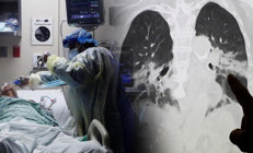 Uzun Kovidden sonra şimdi de uzun grip