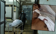 Akılalmaz olay Ölü sanıp morga kaldırdılar ertesi sabah hareket etmeye başladı