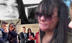 Türkiye günlerce Berfin Özeki konuşmuştu Yüzüne asit atan erkek arkadaşıyla evlendi