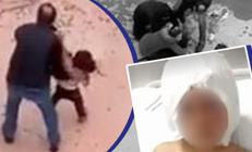 Pitbull saldırısına uğrayan Asiyenin doktoru son sağlık durumunu açıkladı: Meslek hayatımda görmedim