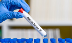 Omicron varyantı pandeminin sonunu mu getirecek 1 SORU 4 UZMAN