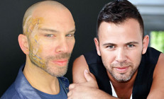 Estetik operasyonu geçiren Berksan: Bırakın kim ne istiyorsa onu yapsın