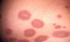 Kendi bebeğine alerjisi mi var Her şey hamile iken başladı...