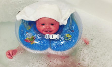 Her gün en az 3 saat banyo yapmak zorunda... 4 yaşındaki Annanın hikayesi...