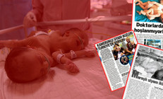 İki kafa ve üç kolla doğan bebekler şaşkına uğrattı... Merak edilenleri Türk doktor anlattı