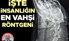 İşte insanlığın en vahşi röntgeni