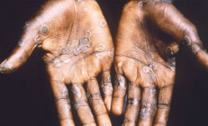 Uzmanlar da şaşkın Nereden çıktı bu maymun çiçeği