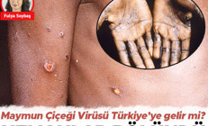 Maymun çiçeği virüsü Türkiyeye gelir mi