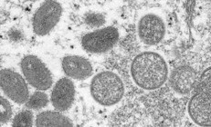 Maymun çiçeği alarmı: Üç ülkede daha yeni vakalar tespit edildi