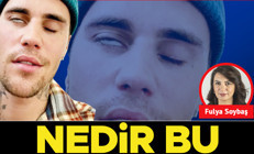 Nedir bu Ramsay Hunt sendromu