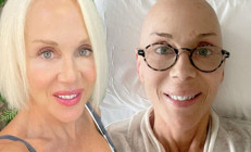 Akciğer kanseri ile mücadele eden Billur Kalkavandan haber var