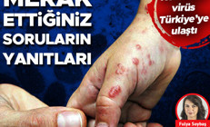 Korkutan maymun çiçeği virüsü Türkiyede