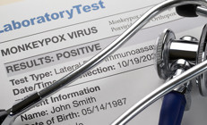 Maymun Çiçeğinde korkutan senaryo: Çok geç kalmış olabiliriz...