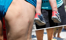 İstanbulda Aedes sivrisineği tehdidi Sayıları giderek artıyor... Uzman isimden önemli uyarı