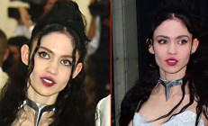 Kepçe kulak ameliyatına eski sevgiliden onay çıkmadı