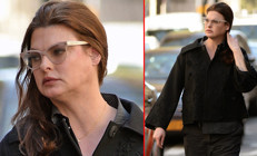 Güzellik uğruna estetik kurbanı olan top modelden acı itiraf: Reklamlara kandım, pişmanım