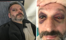 Bursada istek şarkı dehşeti Müzisyeni öldüresiye darbettiler