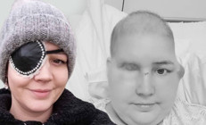 Gözündeki şişlik sonrası kanser olduğunu öğrendi Hastalığa karşı verdiği savaş ölümünden sonra bile devam etti...