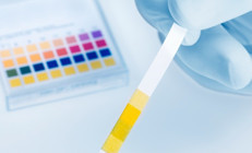 İdrar deyip geçmeyin birçok hastalığın habercisi olabilir... Hangi renk tehlikeli