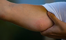 Böcek ısırığı nedeni ile doktora gitti hayatının şokunu yaşadı: Dünyamız yıkıldı, kimsenin başına gelsin istemem