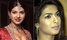 Yanlış burun ameliyatı kariyerinin sonu olacaktı… Adı Plastik Chopra kaldı: Girdiğim depresyondan yıllarca çıkamadım