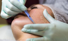 YENİ MODA DERMAPLANING | Bebek gibi cildim olsun derken hata yapmayın, işi uzmanına bırakın