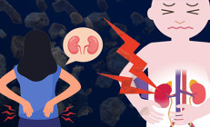 Böbrek taşı vakalarında korkutan artış ‘Sağlıklı insanlarda ve çocuklarda da görmeye başladık, bu endişe verici’