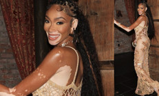 Herkesin alay ettiği günler geride kaldı: Hastalığı şansı oldu, hayatını değiştirdi