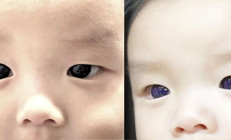 Henüz 6 aylık Koronavirüs tedavisine başlandı gözleri 18 saat içinde maviye döndü...